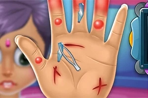 Mano con cortaduras, astillas y ampollas rojas, con pinzas listas para extraer fragmentos