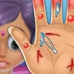 Mano con cortaduras, astillas y ampollas rojas, con pinzas listas para extraer fragmentos