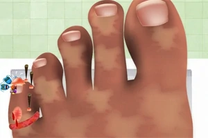 Pie con uñas dañadas, con clavos y una herida en el dedo meñique sobre un fondo de mosaicos verdes