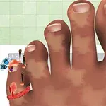 Pie con uñas dañadas, con clavos y una herida en el dedo meñique sobre un fondo de mosaicos verdes